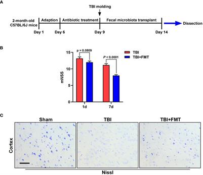 Fecal microbiota transplantation inhibited neuroinflammation of traumatic brain injury in mice via regulating the gut–brain axis